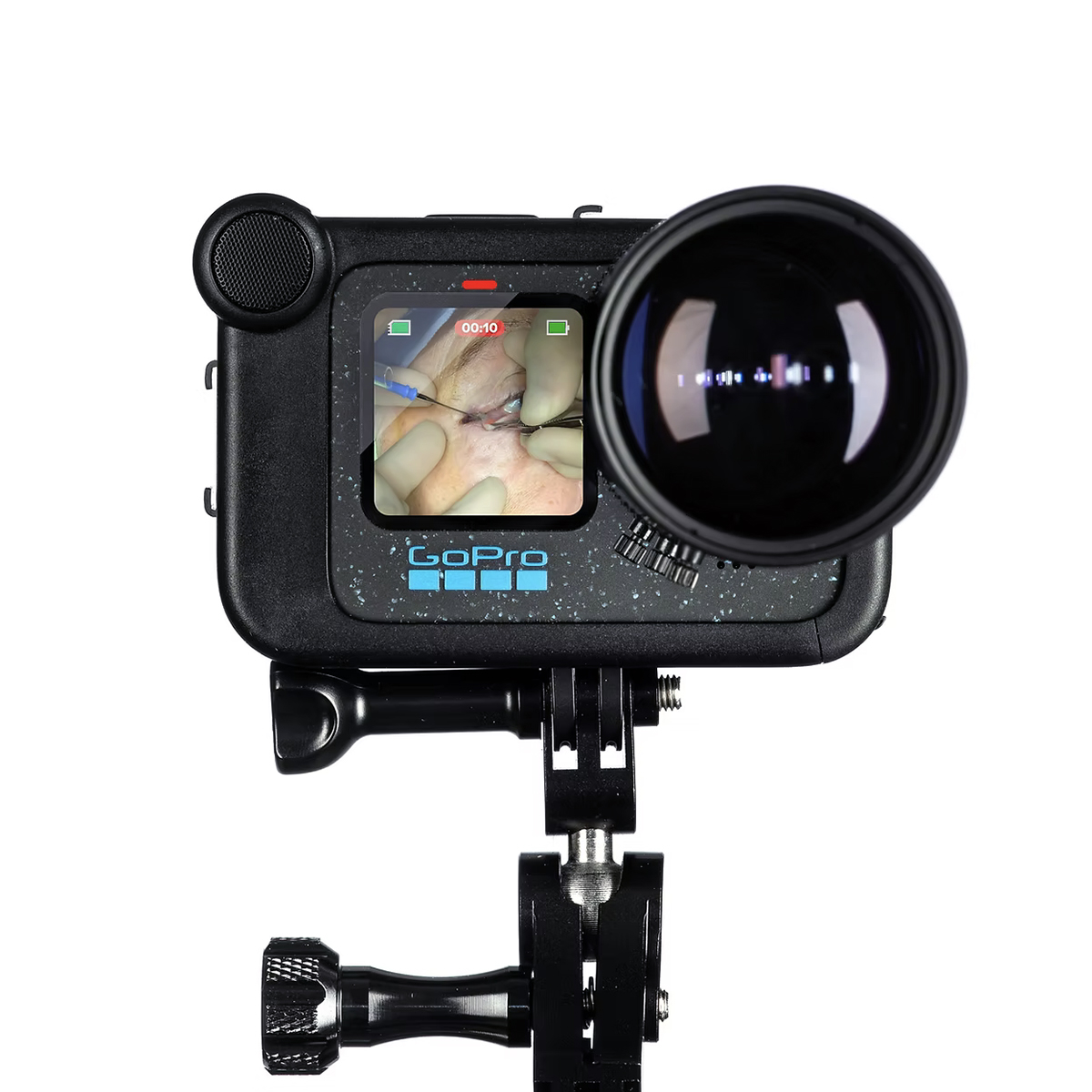 SeeSense OpCam front view